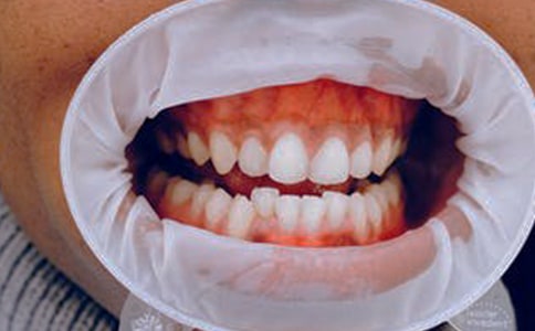 �����׺����l����ʲô�^�e-����A�������׺����l��