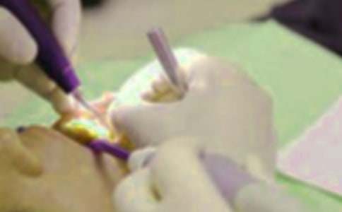 我的拔牙經歷作文(通用26篇)