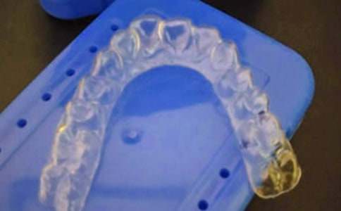 牙套相伴滋味長初一作文750字