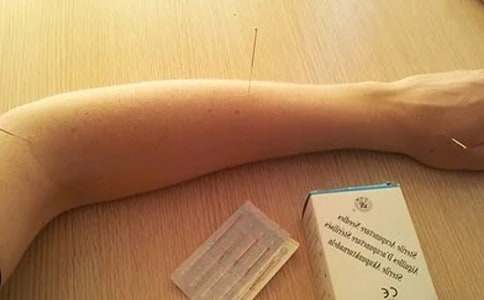 第一次針灸作文(通用16篇)