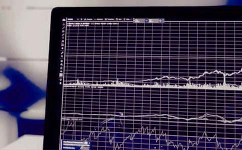 證券從業考點:股份制改組